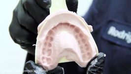پرینت سه بعدی اسکن پرینت محافظ دندان