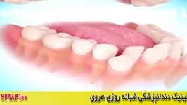 ارتودنسی چه جوری دندان ها را مرتب می کند