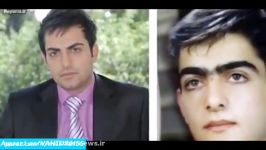بازیگران هنرمندان ایرانی قبل بعد عمل زیبایی