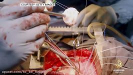 Transporting a beating heart for transplant  TechKnow