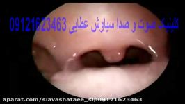 گفتاردرمانی البرز  کمانی شدن چینهای صوتی 09121623463