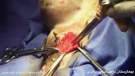 عمل جراحی برداشتن تومور پستانی در یک سگ