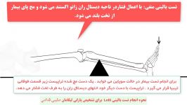 تست بالینی Lelli برای بررسی پارگی لیگامان صلیبی قدامی