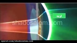 همه چیز در مورد آب مروارید چشم