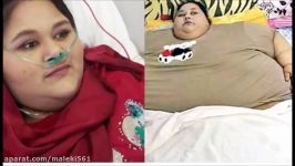 چاق ترین دختر جهان در آستانه باربی شدن تصویری جدید ایمان بعد کاهش وزن