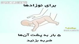 چگونه افراد را خفگی نجات بدهیم