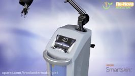 CO2 laser skin resurfacing  ReNova Medical SPA