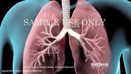 بیماری مزمن انسداد ریوی COPD زیرنویس سایت پرشن فیزیو