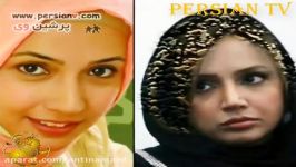 بازیگران زن دختر مشهور ایرانی قبل بعد عمل بینی