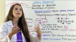 Nephrotic Syndrome Nursing NCLEX Lecture on Pathophysiology Treatment in Children Pediatric