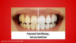 Professional Teeth Whitening Facts You Should Know...