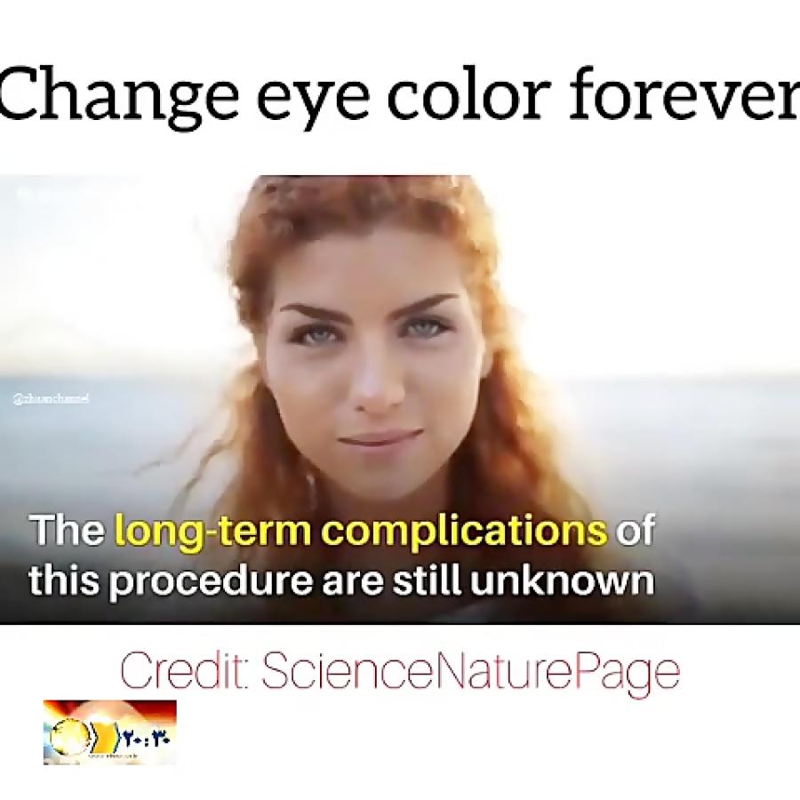 عمل عجیب حیرت انگیز تغییر رنگ چشم لیزر