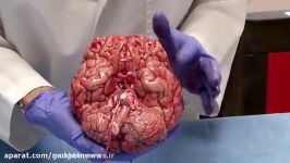 کالبدشکافی مغز انسان