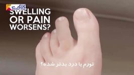 درمان خانگی فرو رفتن ناخن در گوشت انگشت پا