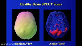 Modern Psychiatry and SPECT Imaging  LELB Society