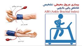 تشخیص تنگی عروق پا