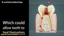 ترمیم دندان استفاده سلول های بنیادی