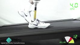 Trés  Treadmill Foot Function Analysis