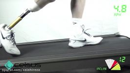 Celsus  Treadmill Foot Function Analysis