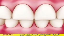 مضرات آسیب های استفاده نکردن مسواک نخ دندان