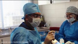 جراحی ایمپلنت  کلینیک دندانپزشکی مهر زعفرانیه