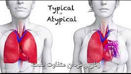 چرا داروها اغلب عوارض نامطلوب بر روی زنان دارند؟