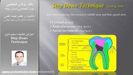 آموزش تکنیک استپ داون Step Down Technique