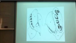 هسته های قاعده ای 3Basal Nuclei پروفسور حسن زاده