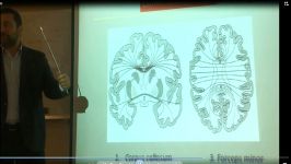 هسته های قاعده ای 4Basal Nuclei پروفسور حسن زاده