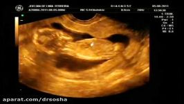 مراحل رشد جنین در رحم مادر هفته چهاردهم بارداری