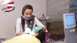 کامپوزیت دندان  کلینیک دندانپزشکی مهر زعفرانیه