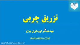 تزریق چربی دکتر بتول طاهری