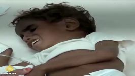 قحطی در یمن