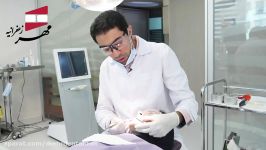 لمینیت سرامیکی قسمت 2  کلینیک دندانپزشکی مهر زعفرانیه