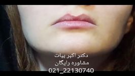 عوارض ناشی نصب غیراستاندارد پروتز گونه در صورت