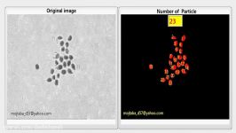 شمارش ذرات میکروسکوپی