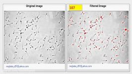 شمارش تصویر میکروسکوپی اسپرم