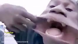 دهن گشادترین مرد جهان