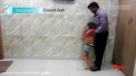 Cerebral Palsy affected children with Crouch Gait