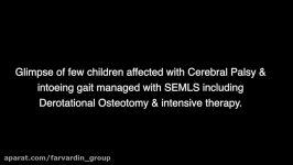 Intoeing gait management in cerebral palsy