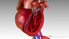 Congestive Heart Failure