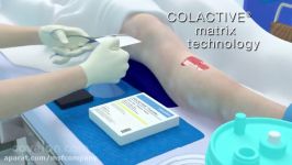 کلاکتیو ترنسفر ColActive Transfer 