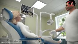 3D animation of dental implant surgery procedure. Alpha Dent Implants