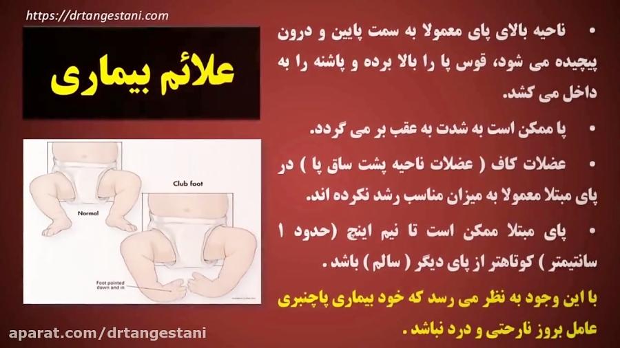 تشخیص درمان پاچنبری دکتر مهرداد تنگستانی نژاد