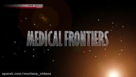 Medical Frontiers  Never Too Late to do healty life style