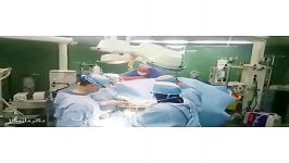 عمل جراحی كرونری پیوند چهار رگ كرونر،قلب در حال طپش