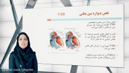 نقص دیواره بین بطنی یا VSD