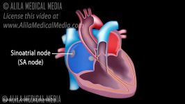 مقدمه ای بر شرایط قلبی سیگنال ECG