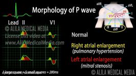 مقدمه ای بر تفسیر سیگنال ECG