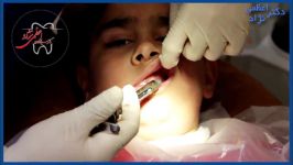 توضیحات دکتر اعظمی نژاد در مورد آبسه دندان